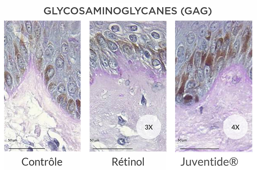 Augmentation des glycosaminoglycanes (GAG pour une hydratation accrue de la peau