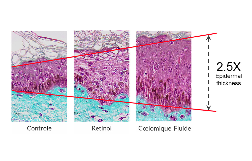 Regeneration of the epidermis and skin tissue