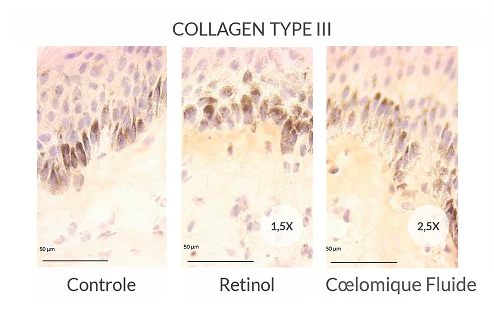 Synthesis of type III collagen