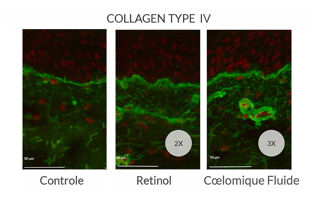 Synthesis of type IV collagen